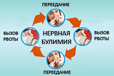 Лечение булимии в Ноябрьске